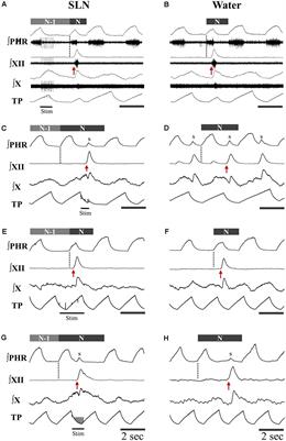 Central Respiration and Mechanical Ventilation in the Gating of Swallow With Breathing